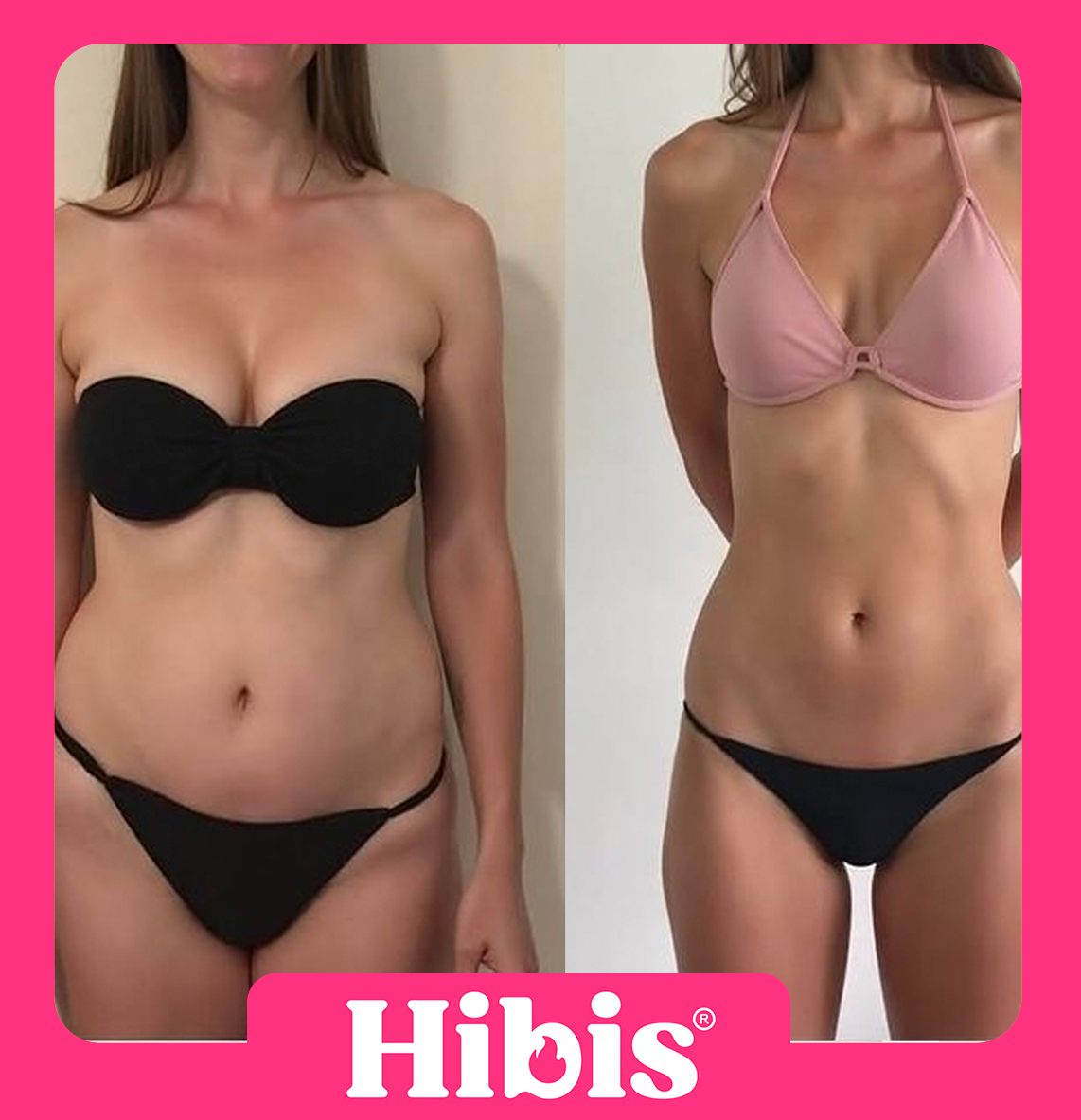 Post Instagram - Transformação com Hibis